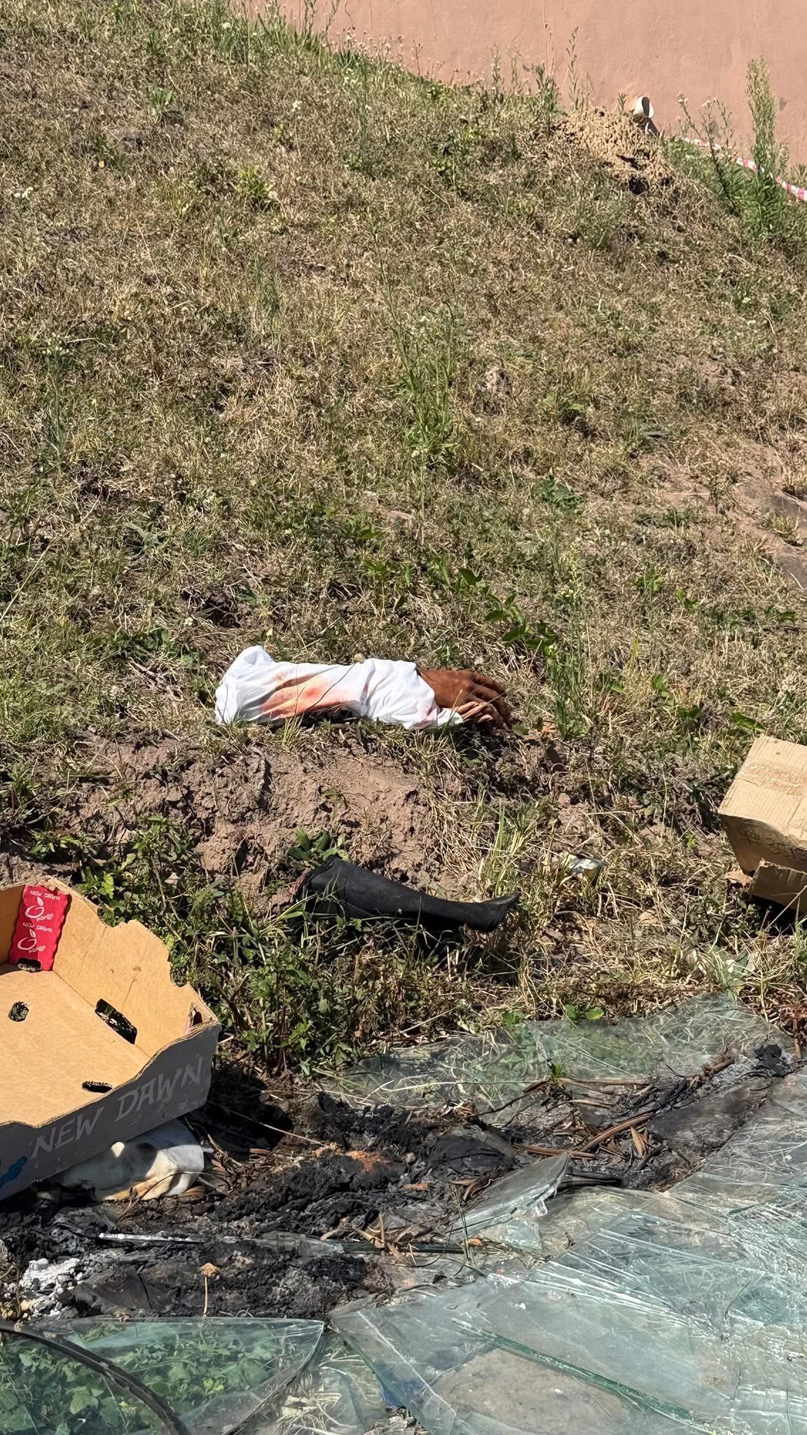 Pair of severed human hands